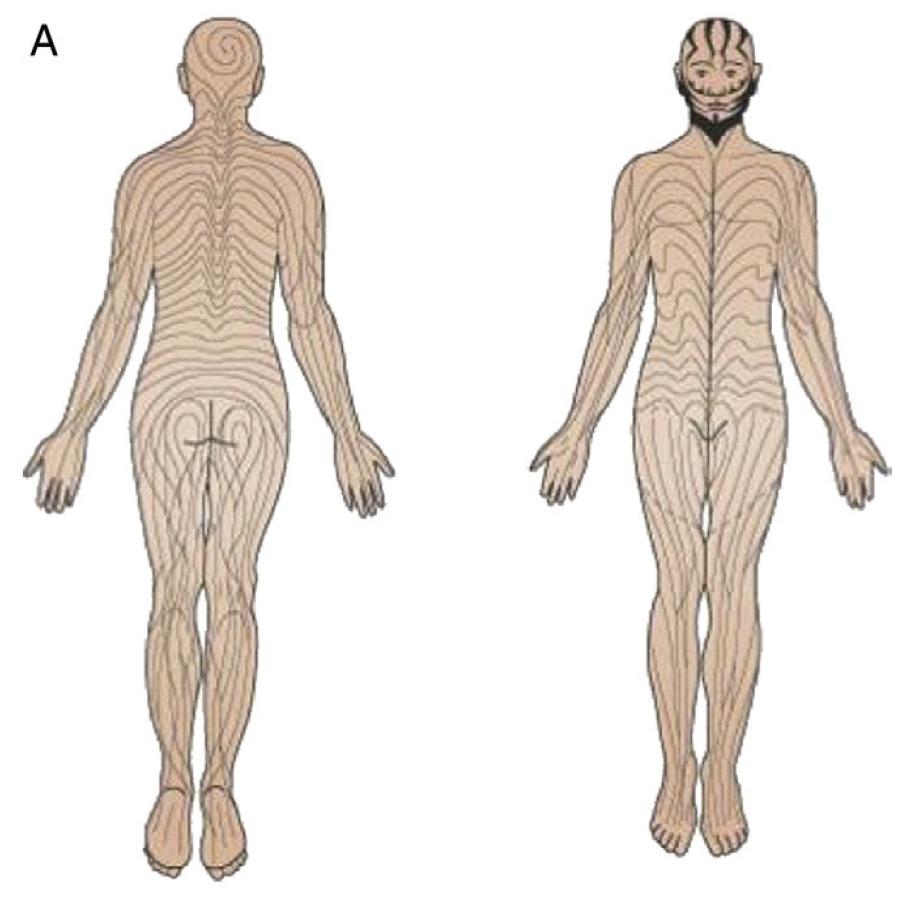 Illustration des lignes de Blaschko sur le devant et le dos d'un corps humain