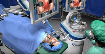 Flex, le robot chirurgien qui pratique des opérations sur des patients !